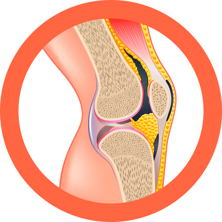 Hondroten - regeneruje stawy i mięśnie