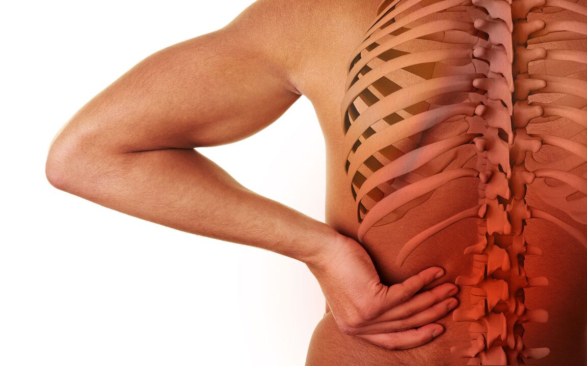 objawy osteochondrozy lędźwiowej