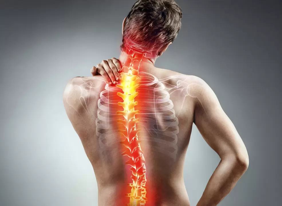 osteochondroza kręgosłupa